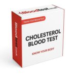 Cholesterol Blood Test in Blackpool: Your Quick Guide